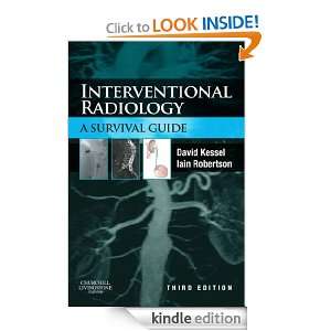 Interventional Radiology A Survival Guide Iain Robertson, David 