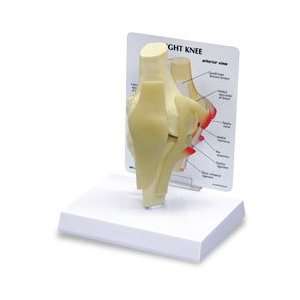    Basic Knee Model + Free Phlebotomy Catalogue 